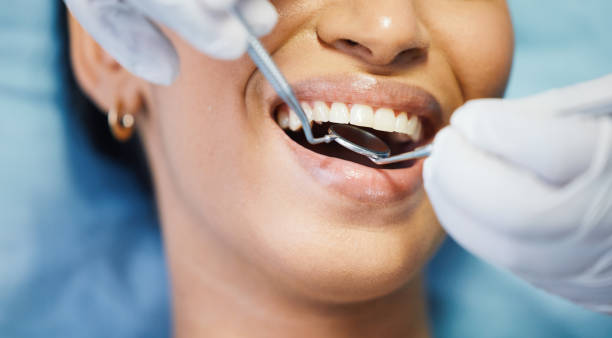 Best Emergency Wisdom Teeth Removal in Sioux Falls, SD