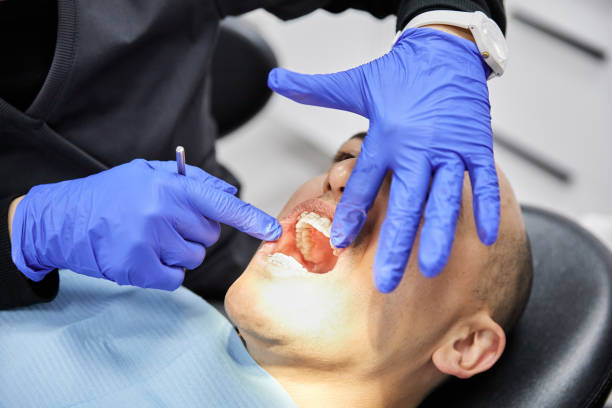 Best Emergency Root Canal Treatment in Sioux Falls, SD